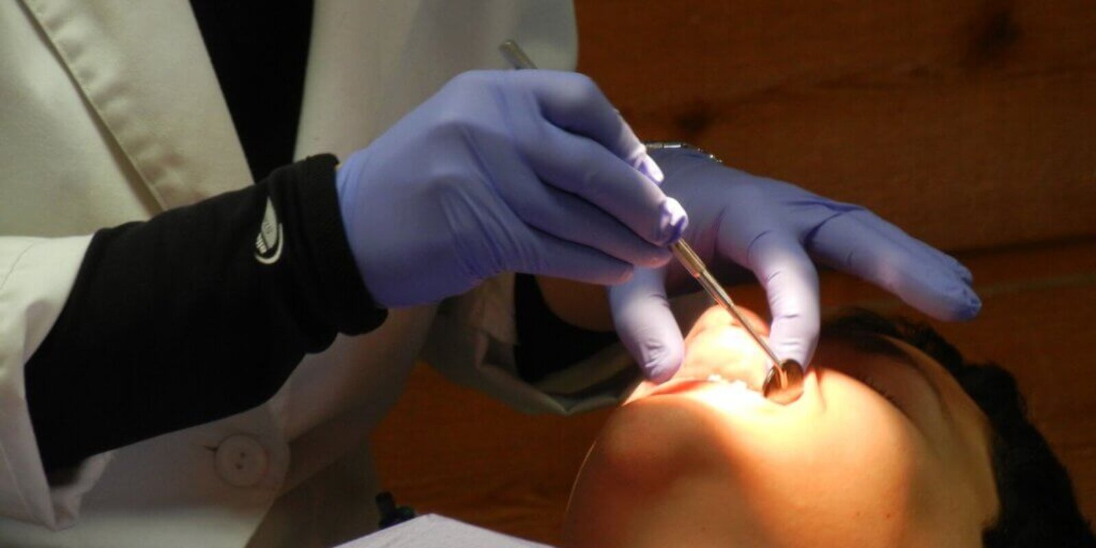 Why You Need to Visit an Orthodontist for Orthodontic Treatment