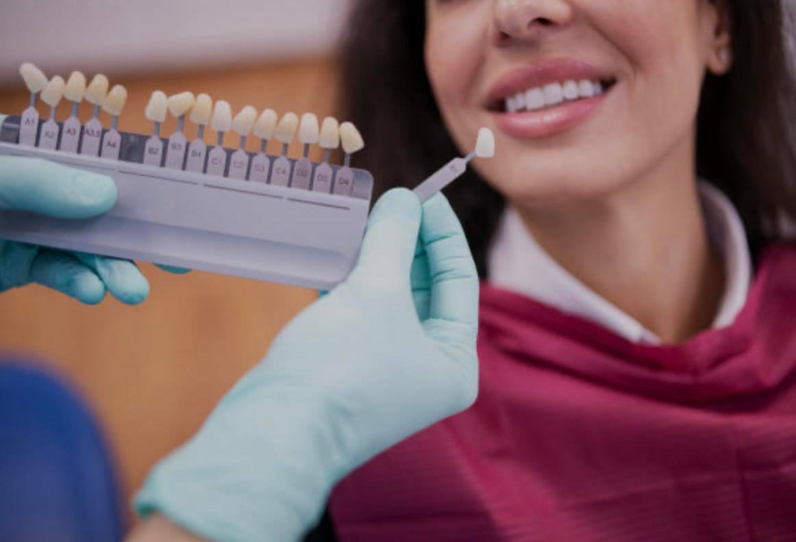 Porcelain Veneers at Boardwalk Dental