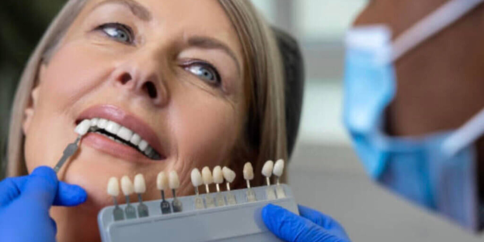 Transform Your Smile with Porcelain Veneers at Boardwalk Dental