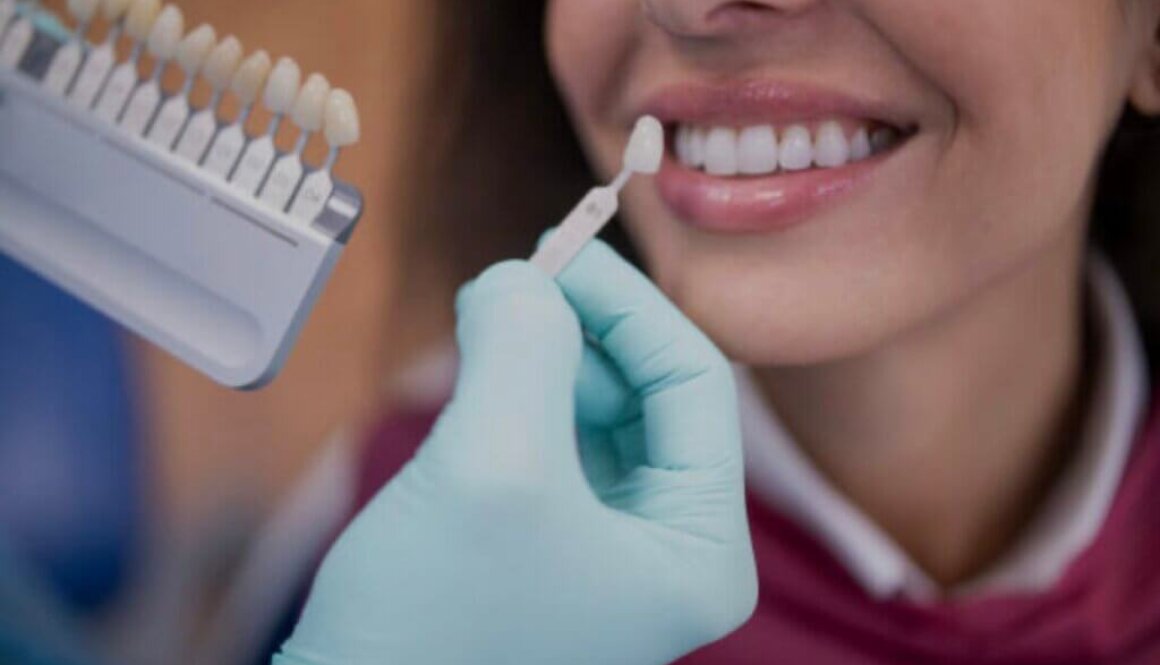 How Dental Implants Can Benefit You 1