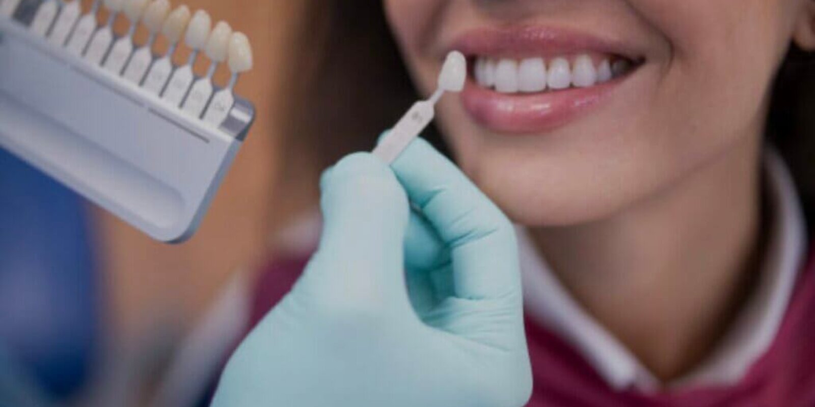 How Dental Implants Can Benefit You 1
